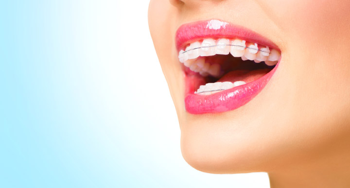 From correcting bites, to occlusion and teeth straightening, we offer not only cosmetic orthodontic treatment, but we also aim at improving oral function in general. Our orthodontist will discuss your needs and goals, have a thorough examination, then help you decide on the best course for your case.