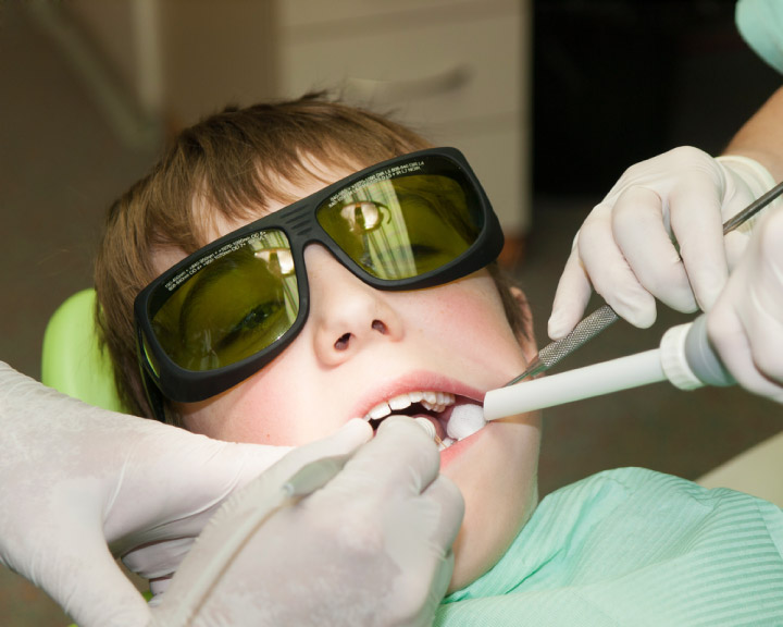 We use lasers as very friendly tools to provide optimal preventive, interceptive and restorative dental care to our young patients in a stress-free environment. Lasers ensure no pain, no anesthesia, no drill, no vibration and no bleeding, which helps manage your child’s anxiety about visiting the dentist.